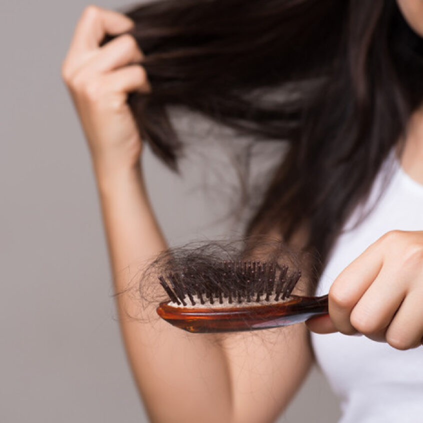 PostCOVID Hair Loss Why It Happens and What to Do About It Charles